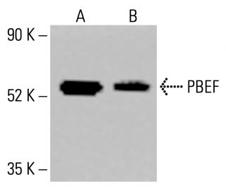 PBEF Antibody (H-11) - Western Blotting - Image 413836