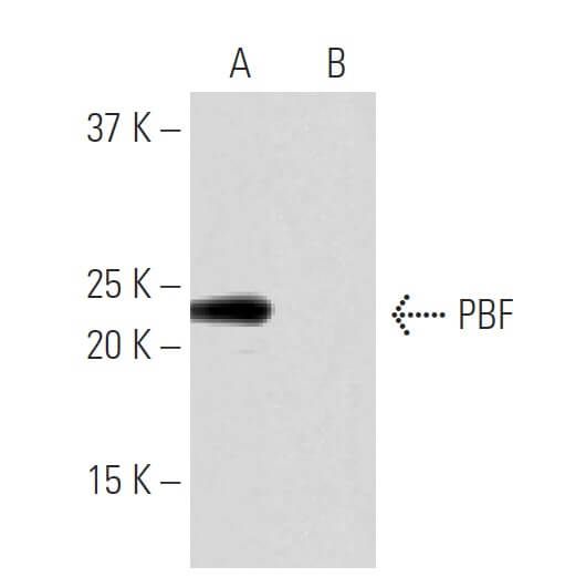 PBF Antibody (NB-A25) | SCBT - Santa Cruz Biotechnology