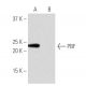 PBF Antibody (NB-A25) - Western Blotting - Image 65028