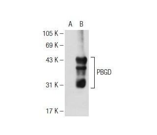 PBGD Antibody (B-3) - Western Blotting - Image 108850 