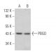 PBGD Antibody (B-3) - Western Blotting - Image 366351 