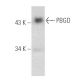 PBGD Antibody (B-3) - Western Blotting - Image 389860