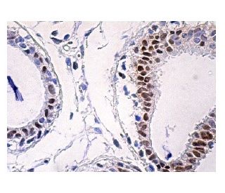 PBGD Antibody (B-6) - Immunohistochemistry - Image 159520 