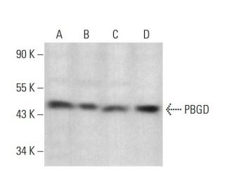 PBGD Antibody (E-9) - Western Blotting - Image 376943 