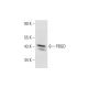 PBGD Antibody (H-11) - Western Blotting - Image 331184 