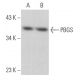 PBGS Antibody (E-10) - Western Blotting - Image 367140