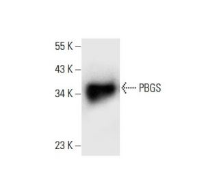PBGS Antibody (G-9) - Western Blotting - Image 303877 