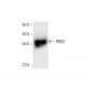 PBGS Antibody (G-9) - Western Blotting - Image 303877 