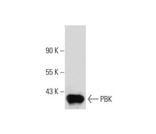 PBK Antibody (31) - Western Blotting - Image 131337 