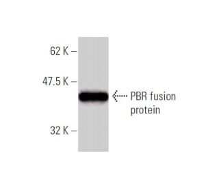 PBR Antibody (3D8-B2) - Western Blotting - Image 348446