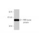 PBR Antibody (3D8-B2) - Western Blotting - Image 348446