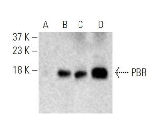 PBR Antibody (E-3) - Western Blotting - Image 396551The Double Nickase Plasmid features a U6 promoter for sgRNA expression, a 20 nt targeting sequence, and a gRNA scaffold to guide Cas9n. It includes a CBh promoter for Cas9n (D10A) and puromycin resistance, GFP for transfection verification, and nuclear localization signals (NLS). The 2A peptide allows co-expression of Cas9n and Puro from a single promoter, enabling precise genome editing with reduced off-target effects.