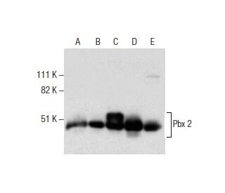 western blotting image from recommended Pbx 2 (1.1) monoclonal antibody replacement. Image 285903