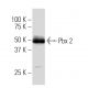 Pbx 2 Antibody (SS-24) - Western Blotting - Image 33640 