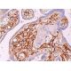 이 다클론 항체는 생산이 중단되었습니다. 권장 <a href="pc-1-antibody-h-7">PC-1 (H-7)</a> 단클론 항체(샘플 데이터 표시)를 참조하세요. immunohistochemistry image from recommended PC-1 (H-7) monoclonal antibody replacement. Image 375194