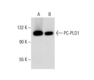 western blotting image from recommended PC-PLD1 (F-12) monoclonal antibody replacement. Image 304207