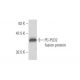 PC-PLD2 Antibody (1C5) - Western Blotting - Image 348568
