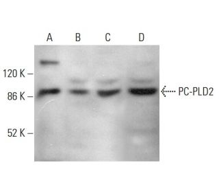 western blotting image from recommended PC-PLD2 (B-3) monoclonal antibody replacement. Image 379872