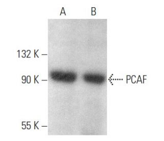 western blotting image from recommended PCAF (E-8) monoclonal antibody replacement. Image 354382