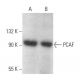 western blotting image from recommended PCAF (E-8) monoclonal antibody replacement. Image 354382