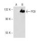 PCB Antibody (F-3) - Western Blotting - Image 141696 