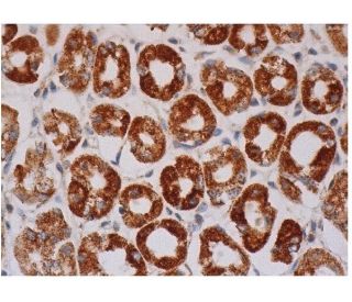 PCCA Antibody (F-4) - Immunohistochemistry - Image 286317 