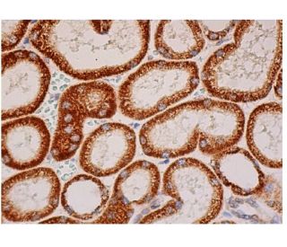 PCCA Antibody (H-1) - Immunohistochemistry - Image 334007 