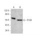 PCCB Antibody (E-7) - Western Blotting - Image 380621