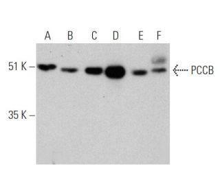 PCCB Antibody (E-7) - Western Blotting - Image 360064