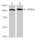 PCDH10 Antibody (2-YD37) - Western Blotting - Image 65029
