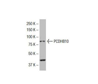 PCDHB10 Antibody (RR-K6) - Western Blotting - Image 33471 