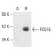 PCGF6 Antibody (A-6) - Western Blotting - Image 403270 
