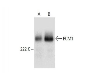 western blotting image from recommended PCM1 (G-6) monoclonal antibody replacement. Image 303923