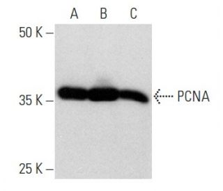 western blotting image from recommended PCNA (PC10) monoclonal antibody replacement. Image 354371