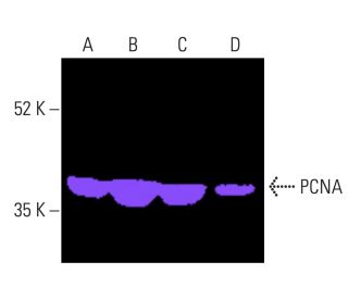 Anticorps PCNA PC10 SCBT Santa Cruz Biotechnology