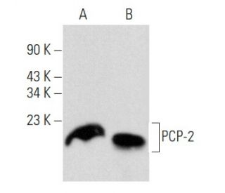 PCP-2 Antibody (F-3) - Western Blotting - Image 357948Each CRISPR/Cas9 Knockout (KO) Plasmid product consists of a pool of 3 plasmids designed to ensure identification and cleavage of a specific gene for maximum knockout efficiency. Each plasmid encodes a unique 20 nt sequence derived from the GeCKO (v2) library. 