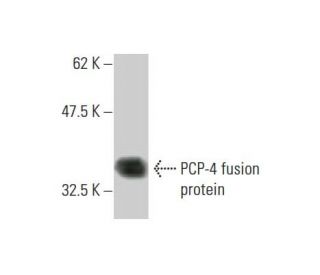 PCP-4 Antibody (1E3) - Western Blotting - Image 348560