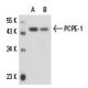 PCPE-1 Antibody (7A11/1) - Western Blotting - Image 16299 
