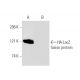 pCruz HA: sc-5045. Western blot analysis of HA-LacZ fusion protein...