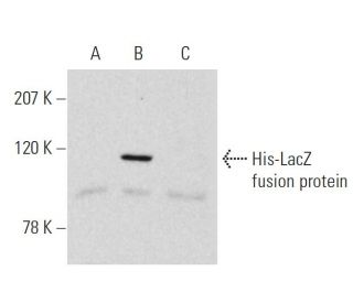 pCruz His: sc-5044. Western blot analysis of His-LacZ fusion protein...