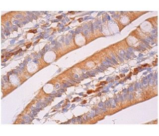 immunohistochemistry image from recommended PCTAIRE-1 (G6.1) monoclonal antibody replacement. Image 284752