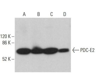 PDC-E2 Antibody (B-2) - Western Blotting - Image 360197 