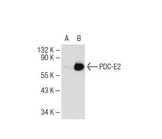 PDC-E2 Antibody (C-1) - Western Blotting - Image 113891