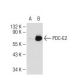 PDC-E2 Antibody (C-1) - Western Blotting - Image 113891