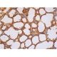 PDCD1LG2/PD-L2 Antibody (TY25) - Immunohistochemistry - Image 386791