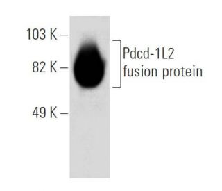PDCD1LG2/PD-L2 Antibody (TY25) - Western Blotting - Image 32810 
