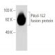 PDCD1LG2/PD-L2 Antibody (TY25) - Western Blotting - Image 32810 