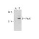 Pdcd-7 Antibody (S-18) - Western Blotting - Image 282118 