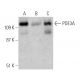 PDE3A Antibody (2D7) - Western Blotting - Image 366687