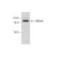 PDE5A Antibody (D-3) - Western Blotting - Image 308176